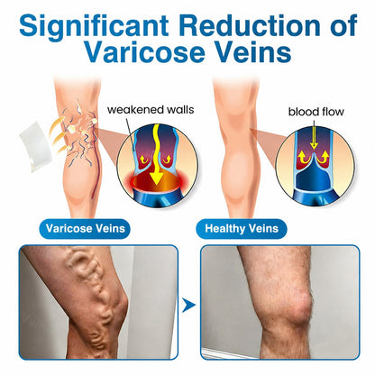 Virexo™ VeinRepair Microneedle Patch Roll⚡Instant Relief, Long-Term Results