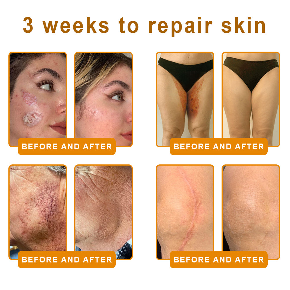 Pryxo™  Bee Poison Skin Restoration Cream 👨‍⚕️（🔥LAST DAY SALE-50% OFF)🥇👩‍⚕️