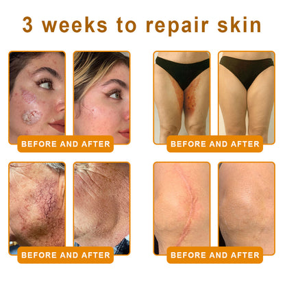 Pryxo™  Bee Poison Skin Restoration Cream 👨‍⚕️（🔥LAST DAY SALE-50% OFF)🥇👩‍⚕️