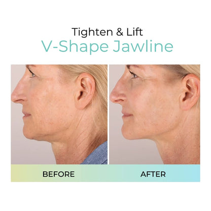 Reveal Firm, Smooth Skin – LUMIVO™ Anti-Wrinkle Pads for Your Youthful Transformation
