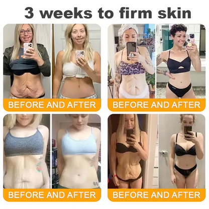 Pryxo™  Bee Poison Skin Restoration Cream 👨‍⚕️（🔥LAST DAY SALE-50% OFF)🥇👩‍⚕️