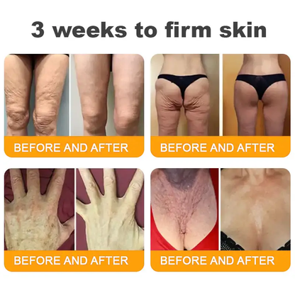 Pryxo™  Bee Poison Skin Restoration Cream 👨‍⚕️（🔥LAST DAY SALE-50% OFF)🥇👩‍⚕️