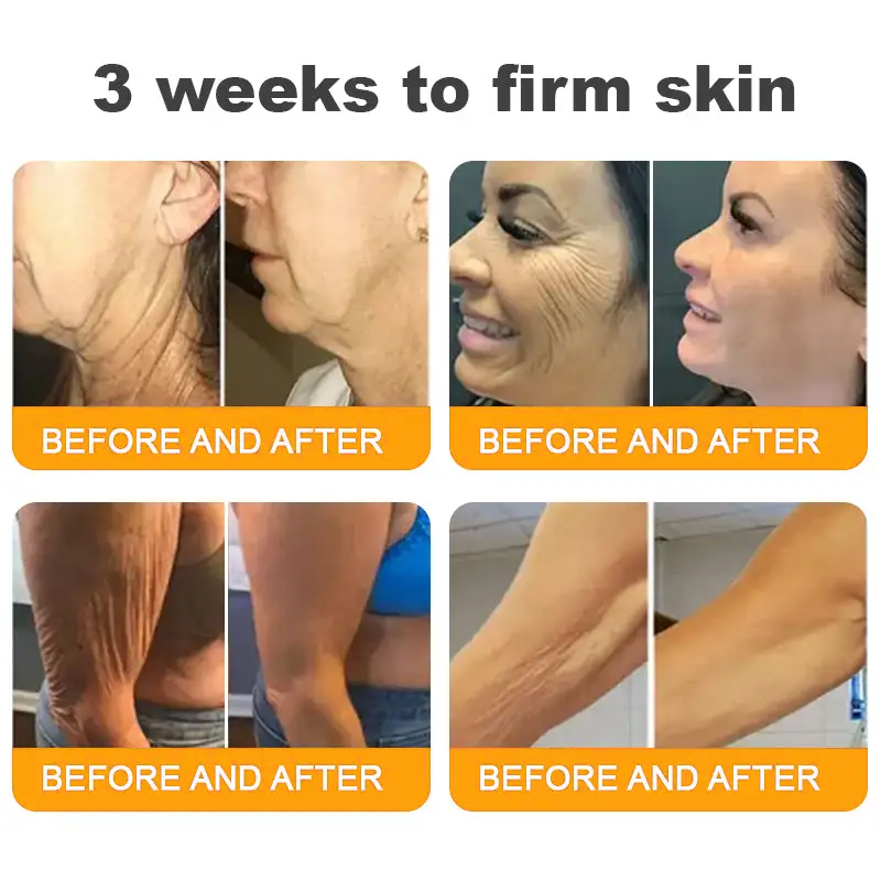 Pryxo™  Bee Poison Skin Restoration Cream 👨‍⚕️（🔥LAST DAY SALE-50% OFF)🥇👩‍⚕️