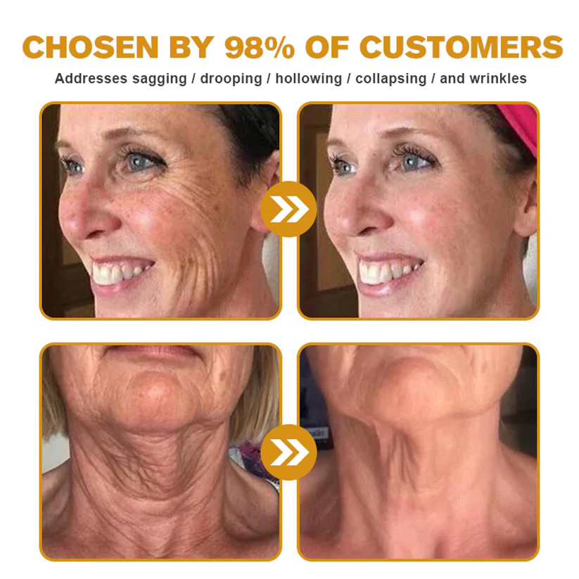 Pryxo™  Bee Poison Skin Restoration Cream 👨‍⚕️（🔥LAST DAY SALE-50% OFF)🥇👩‍⚕️