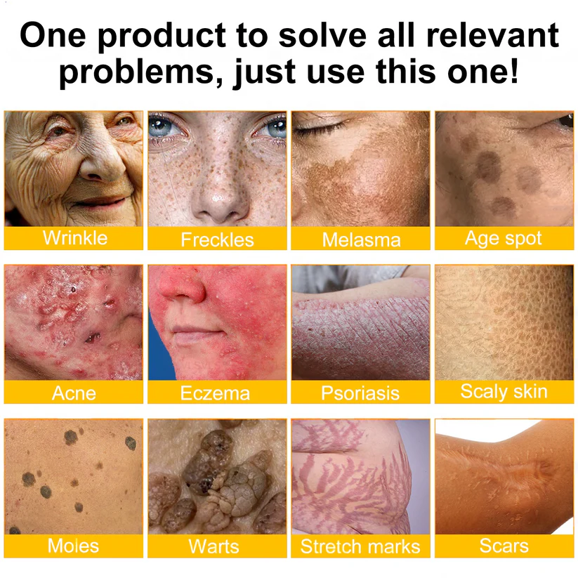 Pryxo™  Bee Poison Skin Restoration Cream 👨‍⚕️（🔥LAST DAY SALE-50% OFF)🥇👩‍⚕️