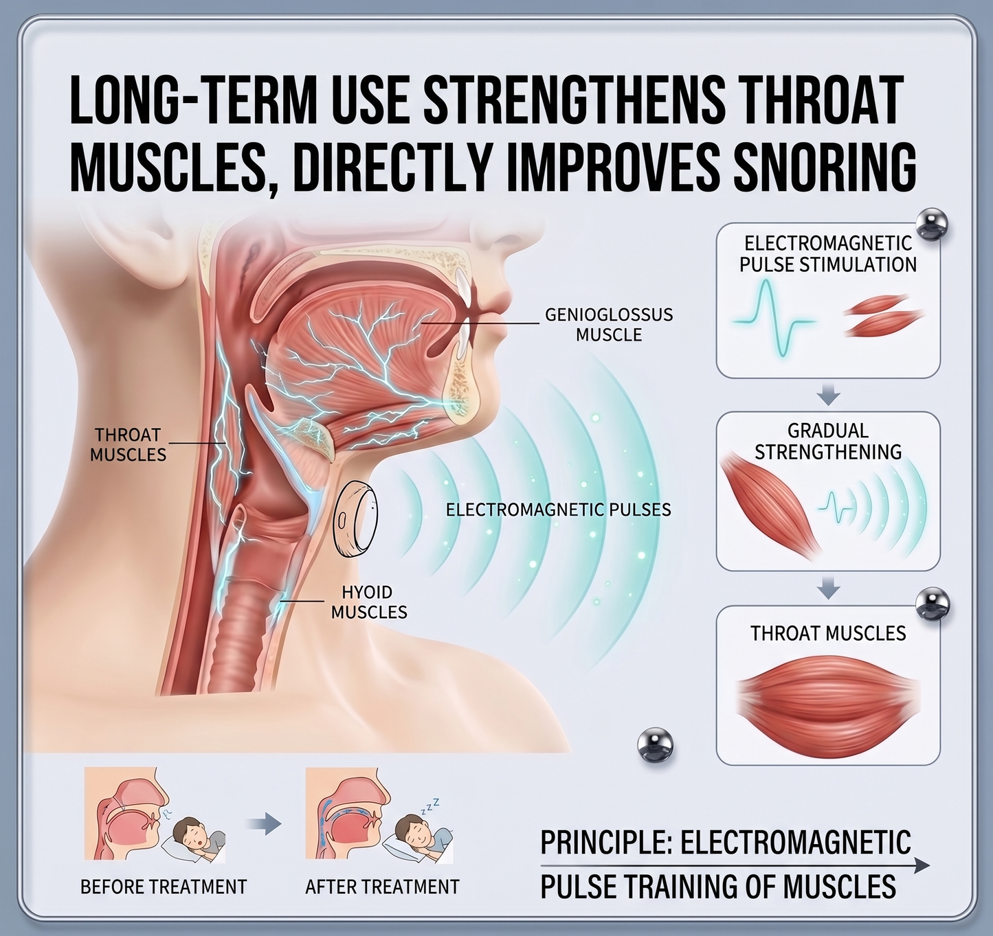 🔥🔥Last 3 Hours: 80% Off🏆 Limited Time Offer – Smart Pulse Anti-Snoring Device